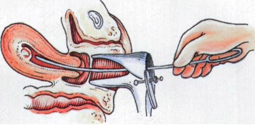 如果不幸流产，这些问题要注意