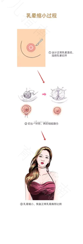 怀孕后乳头变大还疼怎么回事 怀孕后乳头变大还疼怎么回事