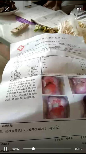 是处女会得宫颈糜烂吗