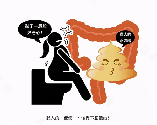 肠癌的腹泻症状表现有哪些? 肠癌的腹泻症状表现有哪些?