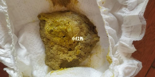 消化不良验大便能验出来吗 消化不良验大便能验出来吗