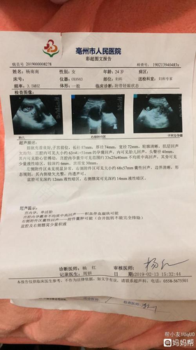 卵巢囊肿破裂会痛吗 卵巢囊肿破裂会痛吗