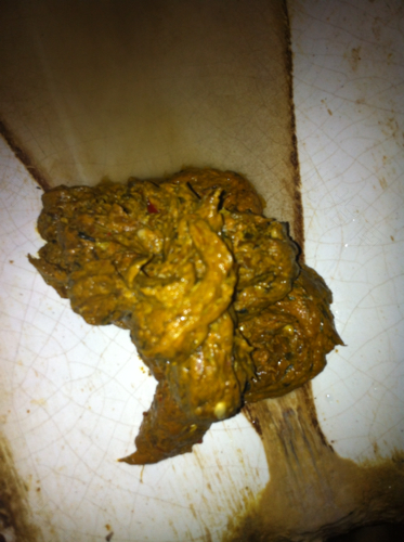 老人频繁大便怎么回事