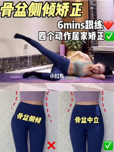 女性骨盆侧倾的危害