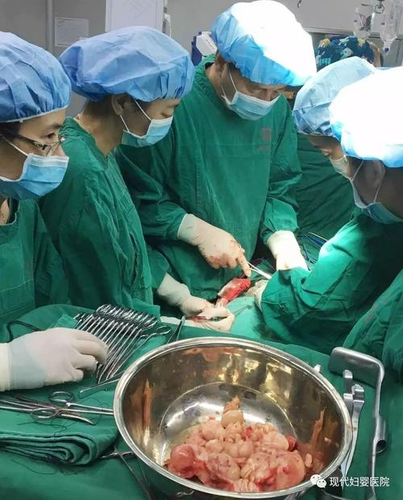 子宫肌瘤术后多久恢复正常 子宫肌瘤术后多久恢复正常