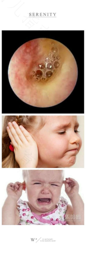 孕妇上火了耳朵疼怎么办 孕妇上火了耳朵疼怎么办