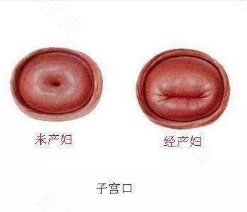 宫颈口变小了是什么的原因 宫颈口变小了是什么的原因