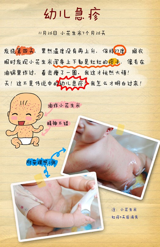 小孩出幼儿急疹能洗澡吗 小孩出幼儿急疹能洗澡吗