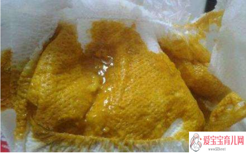 排便周期长怎么办