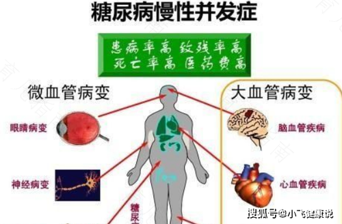 长期血糖高有什么危害 长期血糖高有什么危害