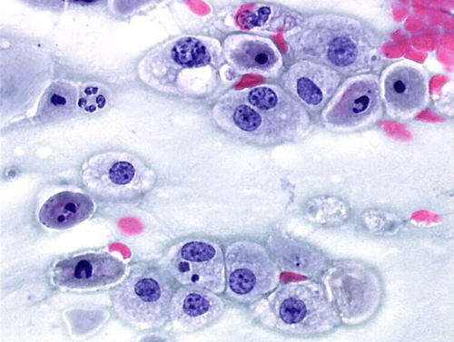 宫颈颈管细胞是什么 宫颈颈管细胞是什么