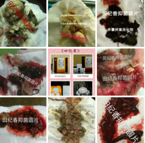 怎样促进残留物排出子宫 怎样促进残留物排出子宫