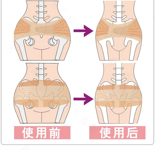 骨盆修复几天做一次好 骨盆修复几天做一次好