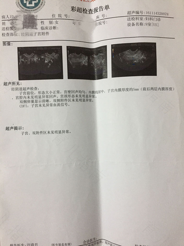 盆腔炎症通过什么能检查出来 盆腔炎症通过什么能检查出来