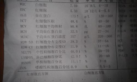 尿常规正常,查出尿毒症 尿常规正常,查出尿毒症