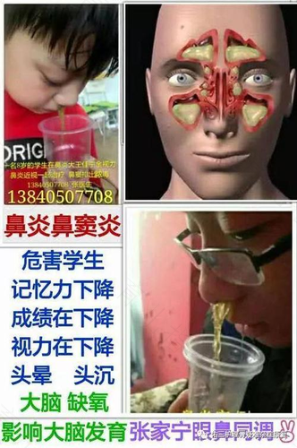 一侧鼻窦炎是怎么回事