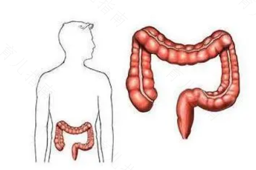 肠子拧紧疼是怎么回事 肠子拧紧疼是怎么回事