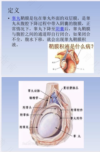 男性阴囊肿胀是什么原因 男性阴囊肿胀是什么原因