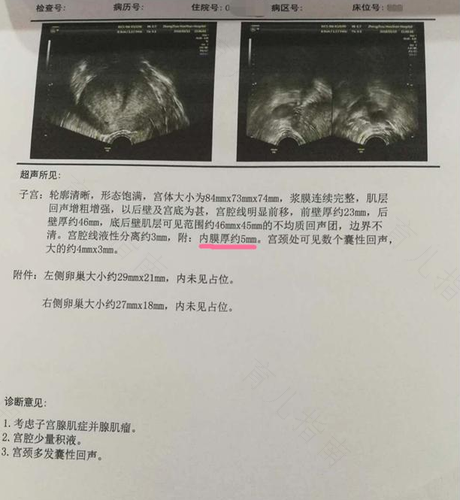 子宫内膜厚会导致不孕吗 子宫内膜厚会导致不孕吗