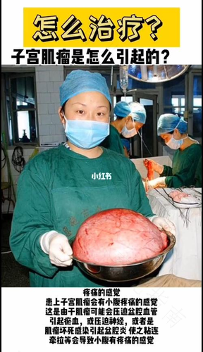 子宫肌瘤有什么方法可以治疗 子宫肌瘤有什么方法可以治疗