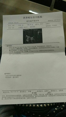 宫颈活检后需要休息吗 宫颈活检后需要休息吗