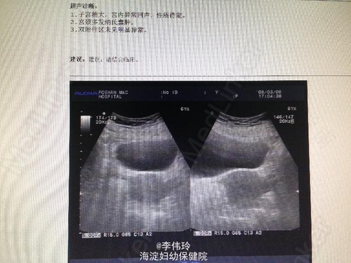 子宫异常出血是怎么造成的? 子宫异常出血是怎么造成的?