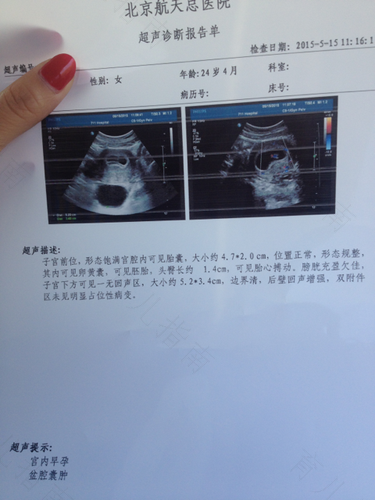 盆腔检查是什么意思 盆腔检查是什么意思