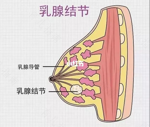 乳腺结节自己会消吗 乳腺结节自己会消吗