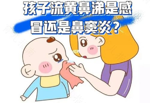 感冒流黄涕是什么感冒 感冒流黄涕是什么感冒