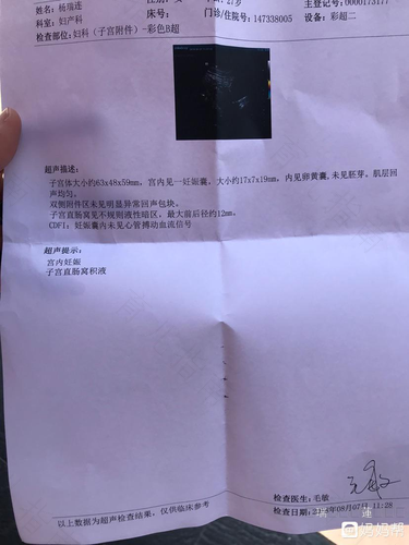 直肠与子宫陷凹少许积液 直肠与子宫陷凹少许积液