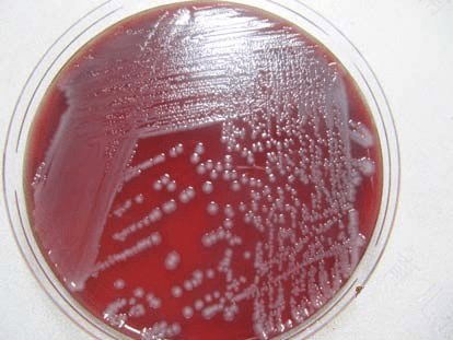 白色念珠菌是厌氧菌吗? 白色念珠菌是厌氧菌吗?