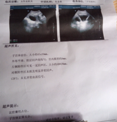 盆腔长了个囊肿严重吗 盆腔长了个囊肿严重吗