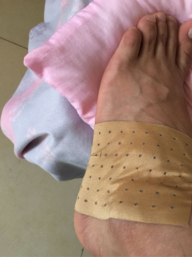 脚丫子疼怎么回事儿 脚丫子疼怎么回事儿