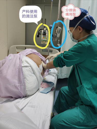 二胎打无痛会延长产程吗