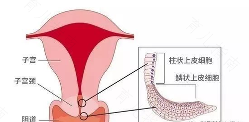 孕妇宫颈厚是什么原因造成的 孕妇宫颈厚是什么原因造成的