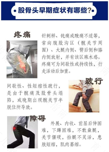 右侧股骨头疼痛是怎么回事