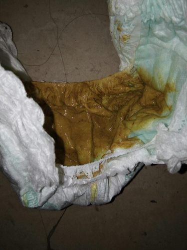 感冒好了拉稀怎么回事 感冒好了拉稀怎么回事