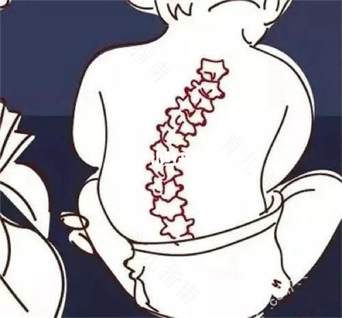 后背脊柱扭伤怎么办 后背脊柱扭伤怎么办