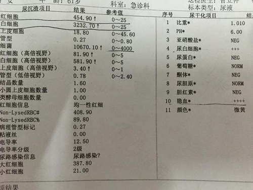 尿常规要多久出结果? 尿常规要多久出结果?