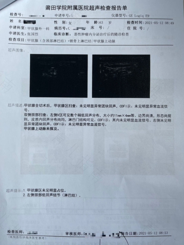 甲状腺活检是什么意思痛不痛 甲状腺活检是什么意思痛不痛
