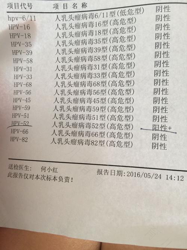 儿童衣原体感染的症状有哪些 儿童衣原体感染的症状有哪些