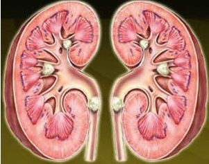 肾结石严重吗?可以治好吗 肾结石严重吗?可以治好吗