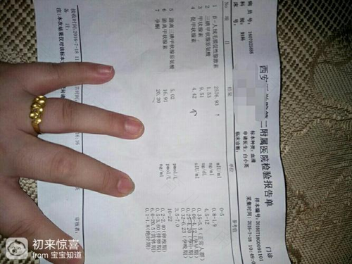 甲状腺素低是甲减吗 甲状腺素低是甲减吗