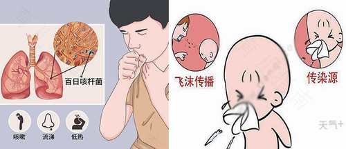百日咳是什么病严重吗 百日咳是什么病严重吗