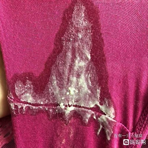 红色粘稠白带不是血 红色粘稠白带不是血