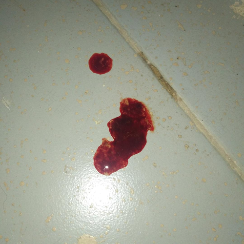 拉出来血水怎么回事 拉出来血水怎么回事