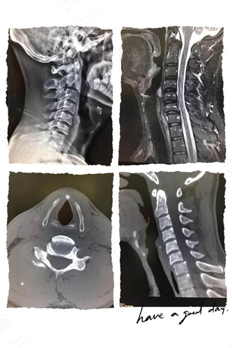 x光和磁共振有什么区别 x光和磁共振有什么区别