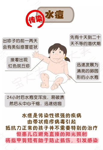 水痘潜伏期能治疗吗 水痘潜伏期能治疗吗