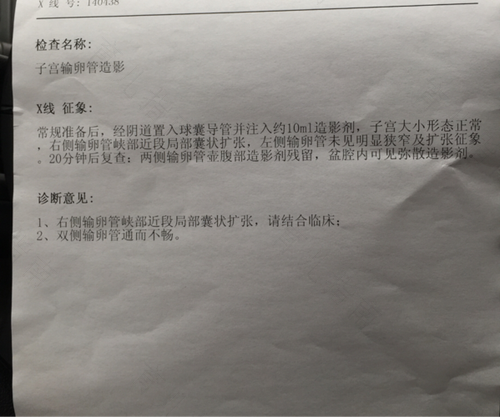 输卵管造影片子怎么看通不通 输卵管造影片子怎么看通不通