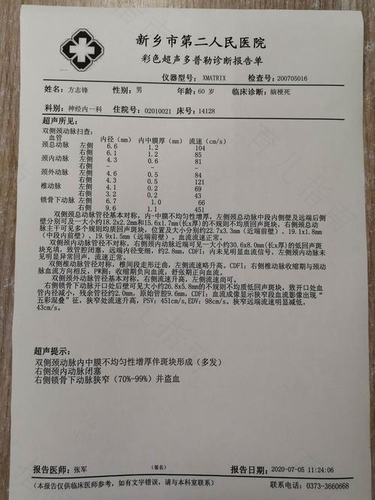 短暂性脑缺血怎么治疗 短暂性脑缺血怎么治疗